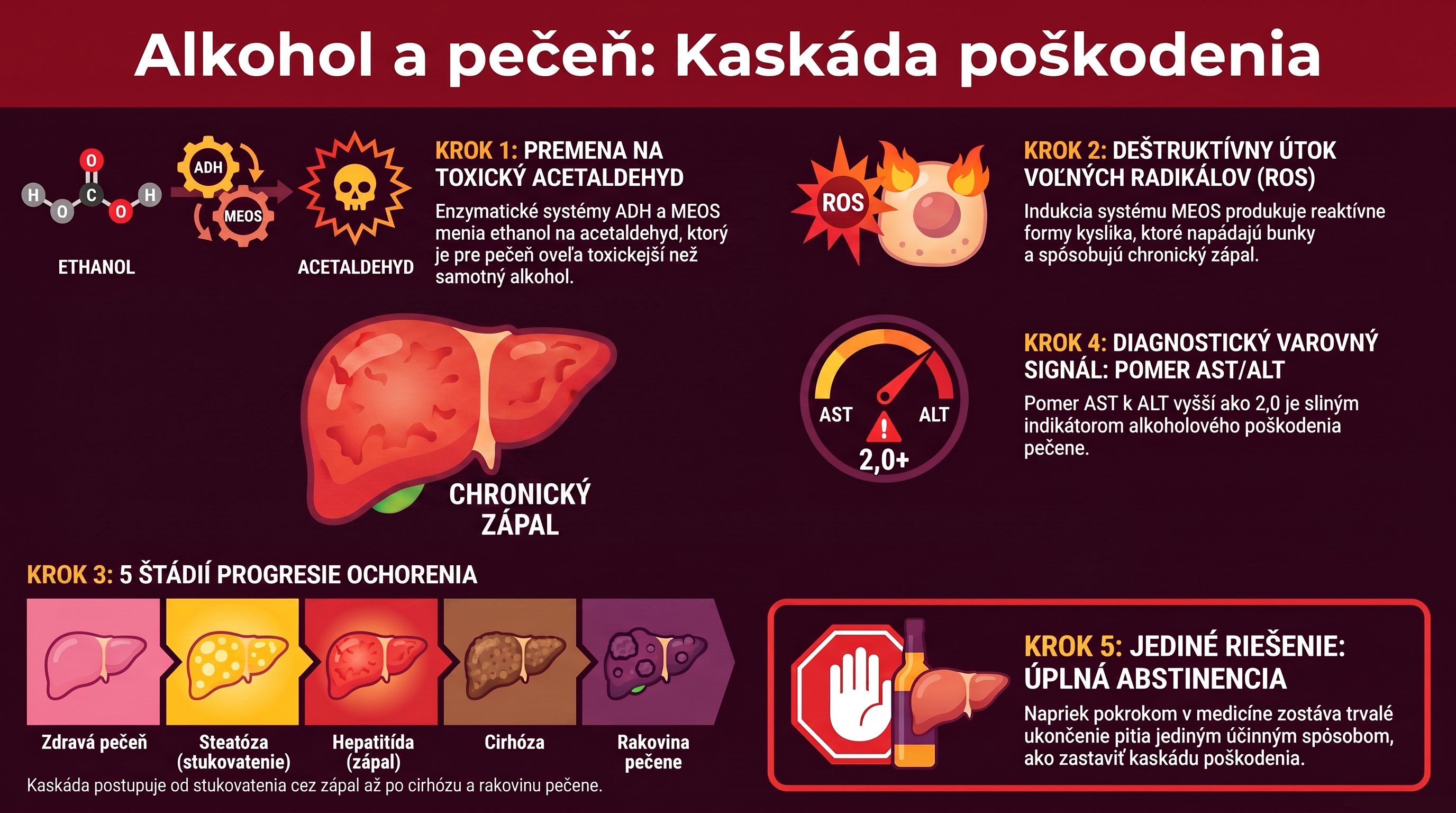 Alkohol_a_poškodenie_pečene
